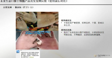 “Futurevita未来生命”：包装成海外健康项目，能治疗各种疾病？</a>
